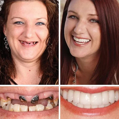 Offer ends today: 50% off! ⏰50% off! KLENIMORE™ Medical Grade, Strong Adhesion, Custom Fit